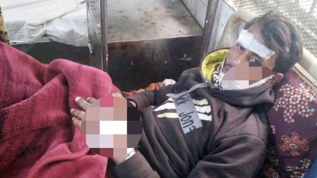 মধুখালীতে গভীর রাতে চোর সন্দেহে আটক, কামড়ে গুরুতর আহত বাড়ির মালিকের ছেলে