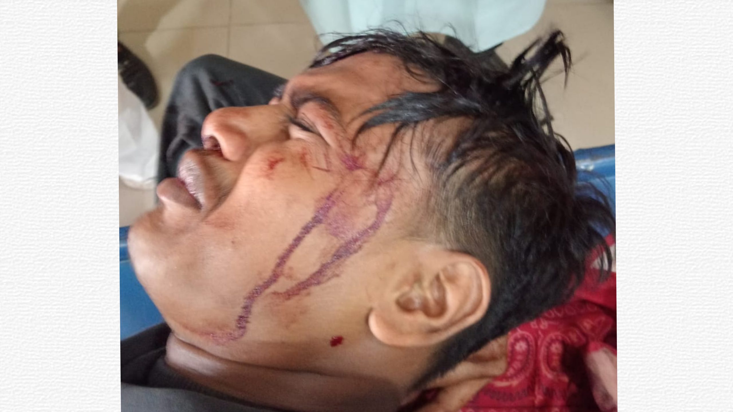 ফরিদপুরে জামায়াতের আমীরের ছেলের ওপর নৃশংস হামলা, হাসপাতালে ভর্তি