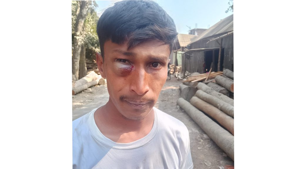 বোয়ালমারীতে জামায়াতের প্রচারণা করায় ভ্যানচালকের চোখে হাতুড়ি হামলার অভিযোগ
