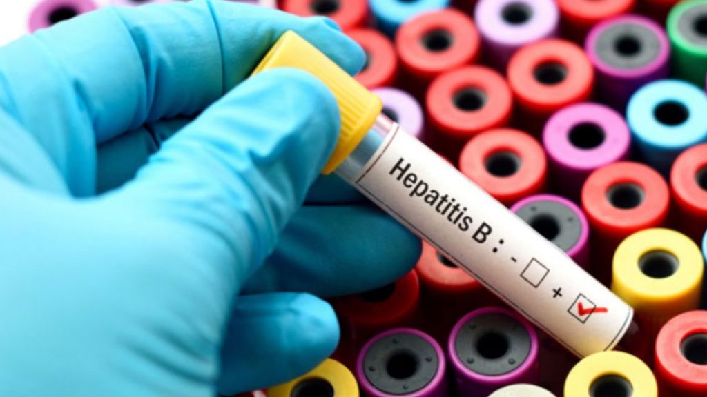 হেপাটাইটিস বি ভাইরাস সম্পর্কে যা জানা জরুরি: ছড়ায় কীভাবে, লক্ষণ ও প্রতিকার?