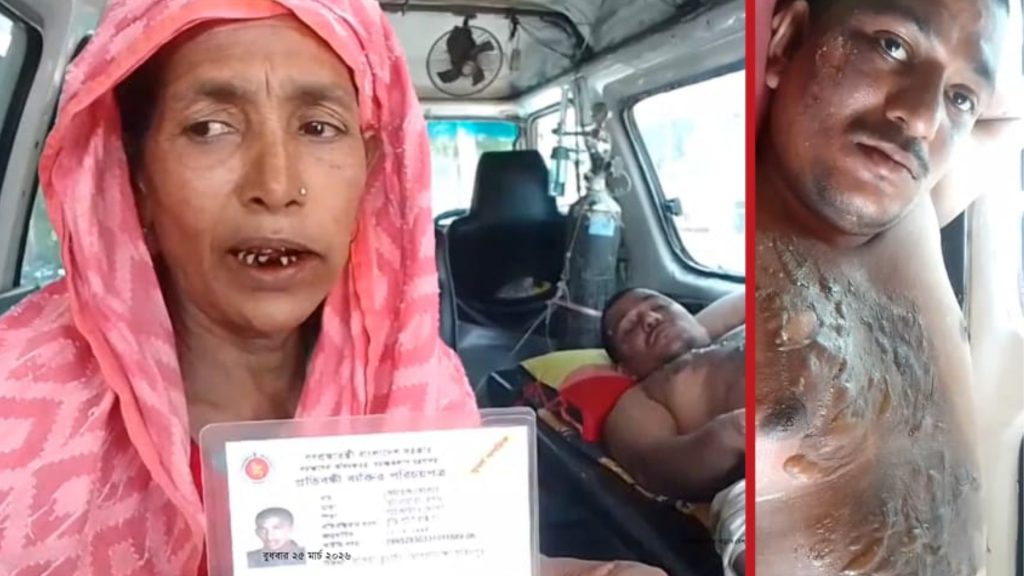 ফরিদপুরে বুদ্ধিপ্রতিবন্ধী যুবককে গরম পানি ঢেলে ঝলসে দেওয়ার অভিযোগ আ.লীগ নেতার বিরুদ্ধে