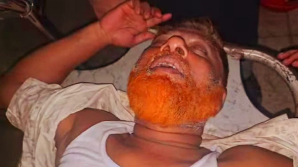 নগরকান্দায় যুবদল নেতার ওপর হামলার অভিযোগ