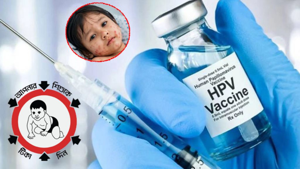 ফরিদপুরে ২০ এপ্রিল থেকে দেওয়া হবে হামের টিকা, চলবে ১০ মে পর্যন্ত