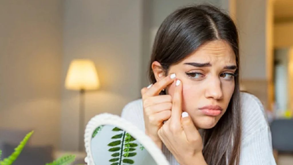 যে ৮ কারণে মুখের চামড়া কুঁচকে যায়?